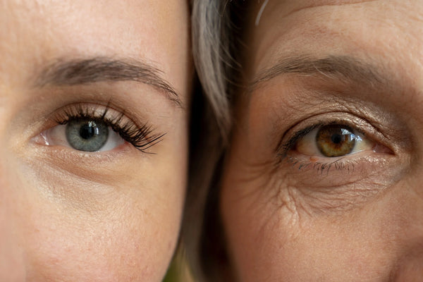 Aging & Wrinkles